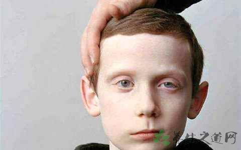 艾灸制面瘫用什么穴位