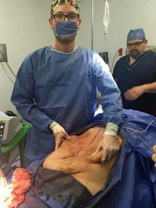 在家人陪同下到医院进行了检查,医生检查后发现她患有巨大的卵巢囊肿