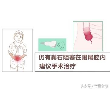 肚子疼,恶心呕吐还发烧,家长警惕孩子是阑尾炎