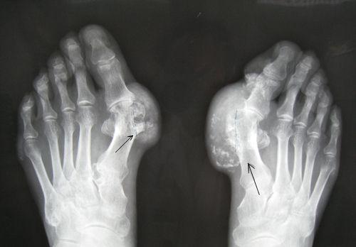 这种没有疤痕的痛,99%的人都害怕再次去经历