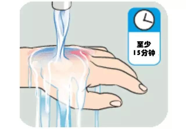 儿童烧烫伤,请牢记这些紧急处理办法,第一点最