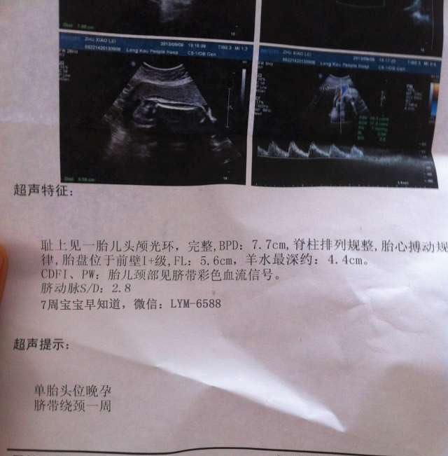 据说香港孕早期可以测胎儿性别?