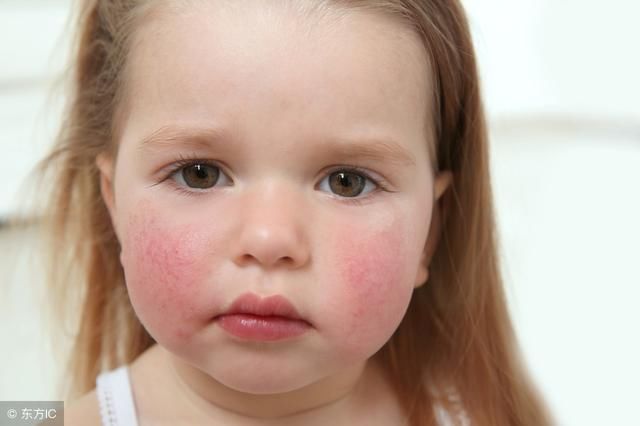 宝宝食物过敏?--这几件事家长一定要搞清楚