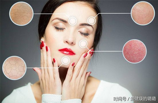 祛红血丝最有效的方法,拯救了我的高原红