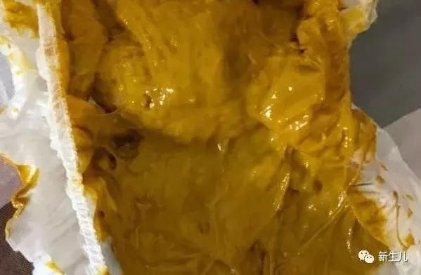 新生儿:宝宝几天不大便怎么办?怎样区别攒肚和