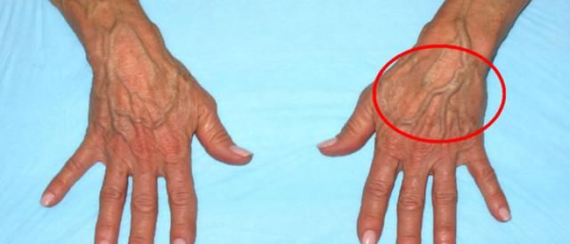 图片中红色为动脉血管,青色为静脉血管,网状为毛细血管.