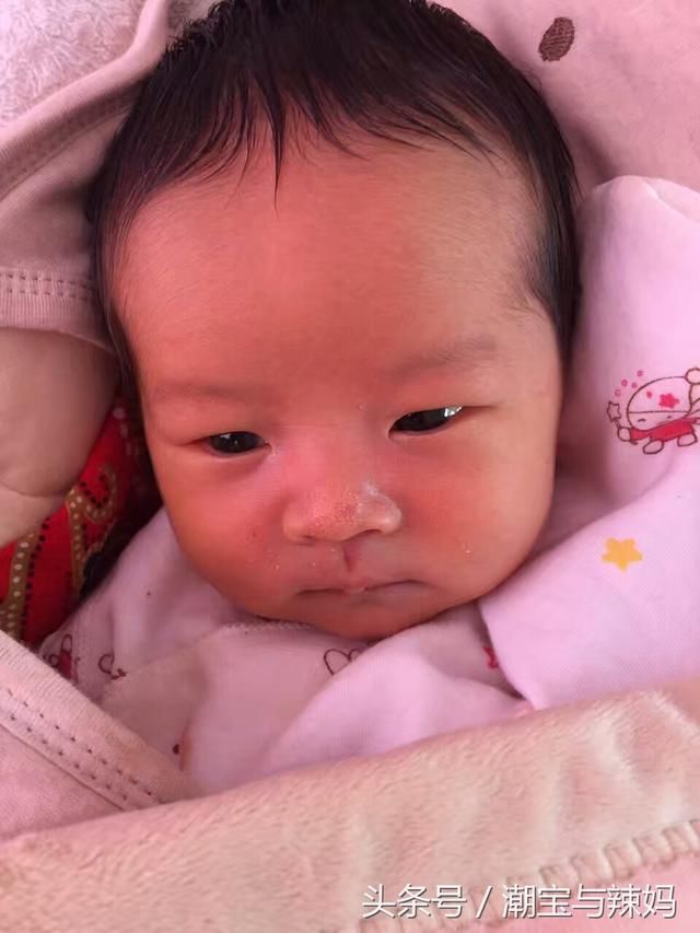 宝宝发烧物理降温冷热毛巾你真的用对了吗