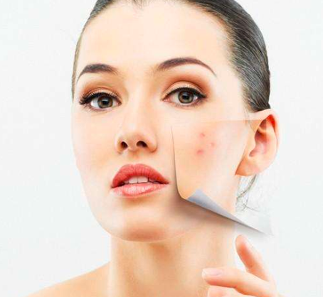 来姨妈右脸长痘痘是什么原因?一个方法保您无