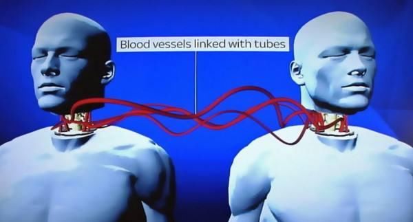 意外!世界首例换头手术成功,换过头的人究竟该