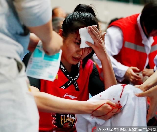 心疼!WCBA山西女篮郭子瑄头部受伤血流满面