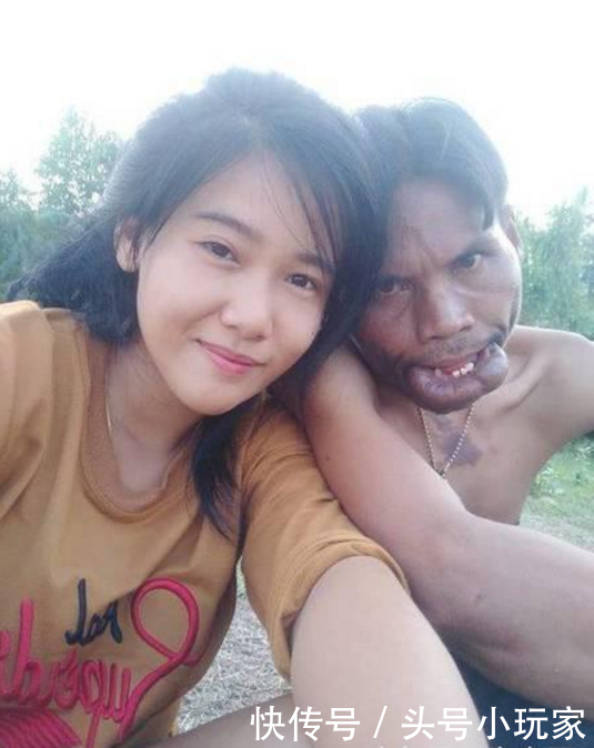 男子丑陋无比,结果却有美女嫁给他跟他生活,网友知道后唏嘘不已