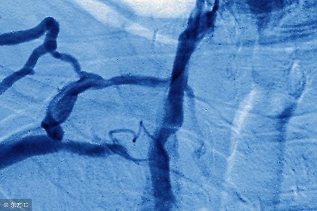 心血管造影有没有危害?