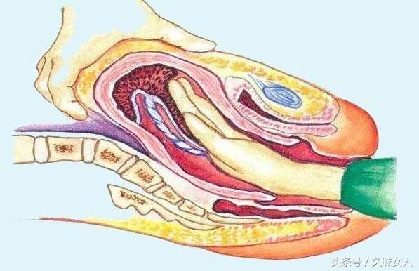 顺产有一种痛,叫手剥胎盘,宝妈:一旦经历,真的