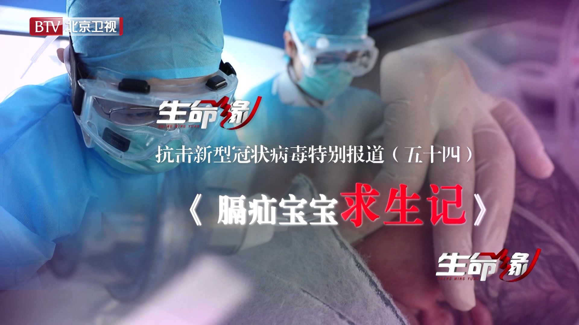 《生命缘》20200323特别报道(五十四)膈疝宝宝求生记 《生命缘》20200323特别报道(五十四)膈疝宝宝求生记
