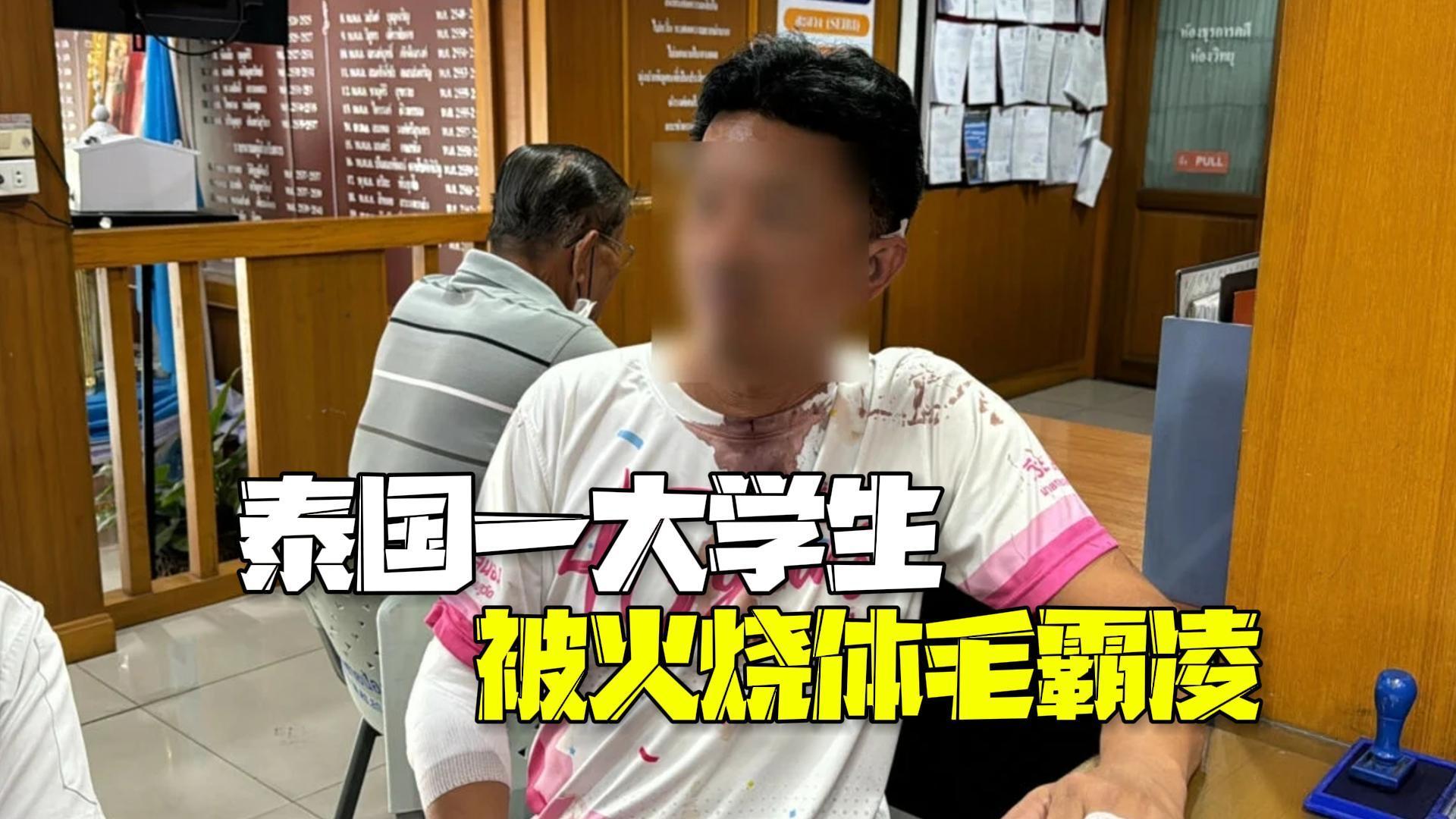 泰国大学生被学长火烧体毛霸凌 申请转校时父子遭群殴住院