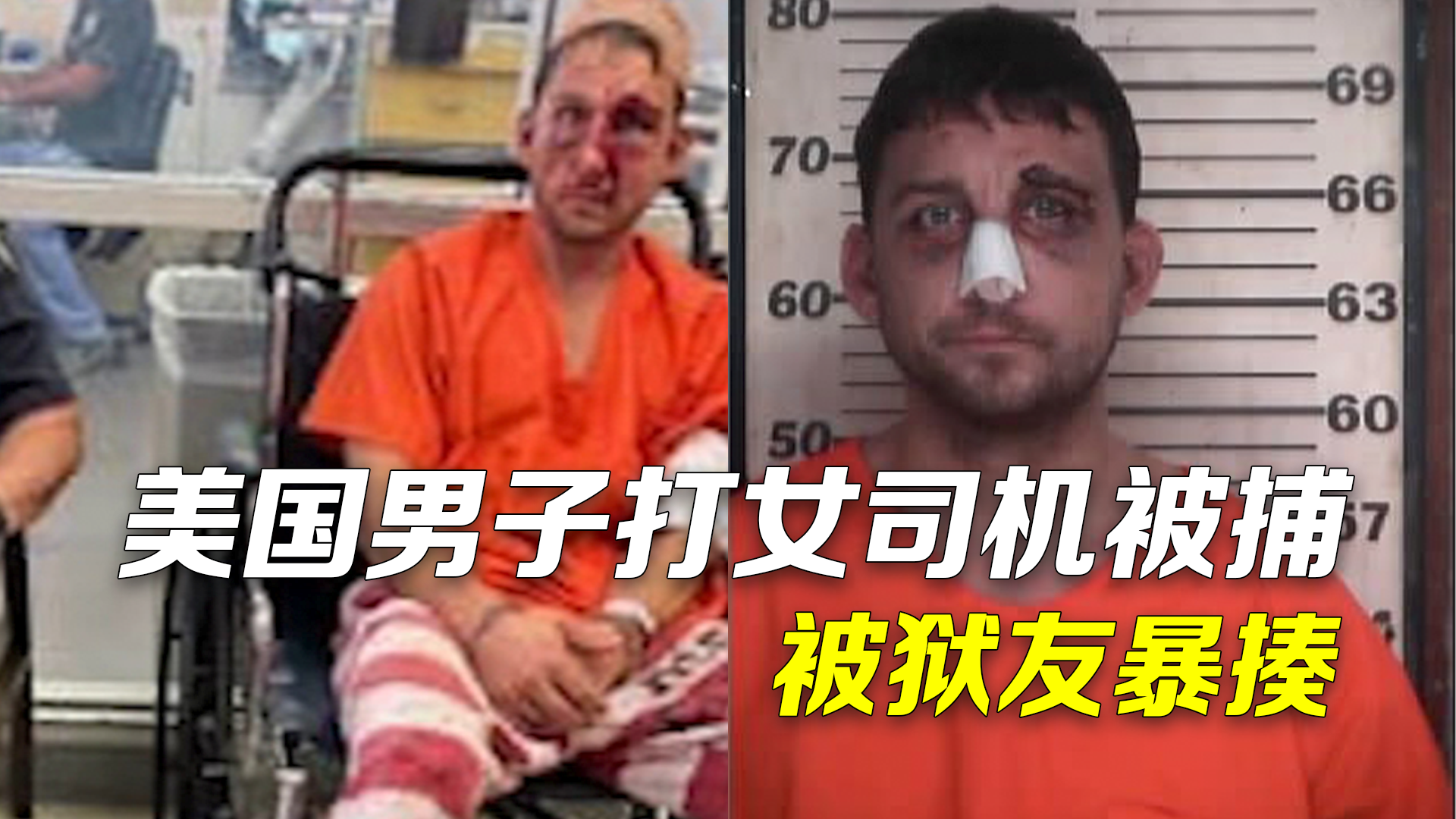 美国路怒惯犯打女司机被捕 被狱友暴揍伤到只能坐轮椅