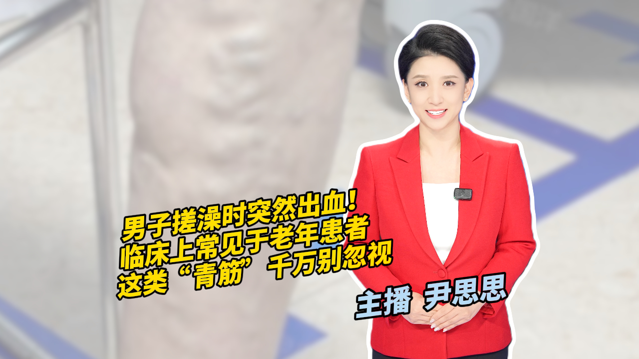 洗澡搓了搓脚 当场喷射出血 老年人可得注意 洗澡搓了搓脚 当场喷射出血 老年人可得注意