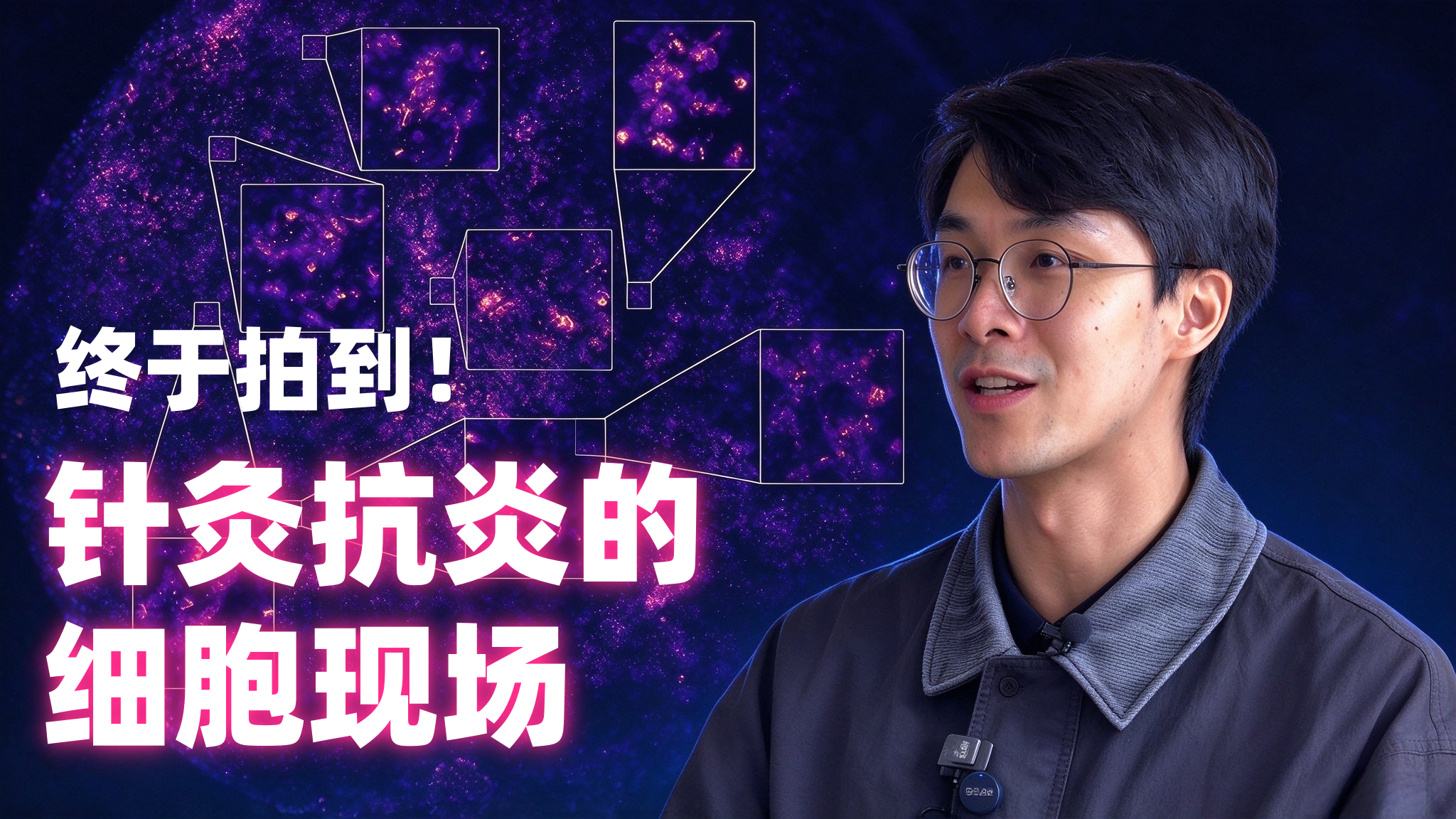 中国自研物镜，首次让针灸效果“被看见”！