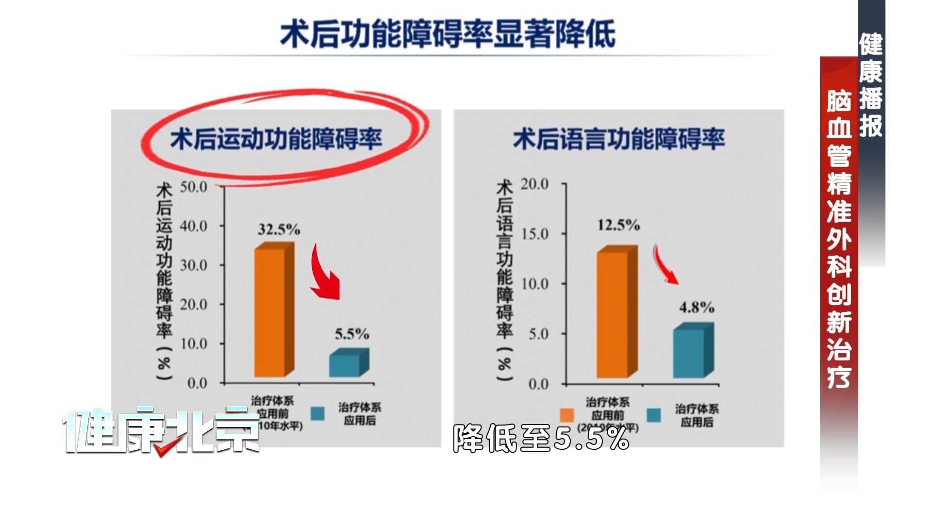 脑部手术如何避免偏瘫失语?AI 给出新答卷! 脑部手术如何避免偏瘫失语?AI 给出新答卷!