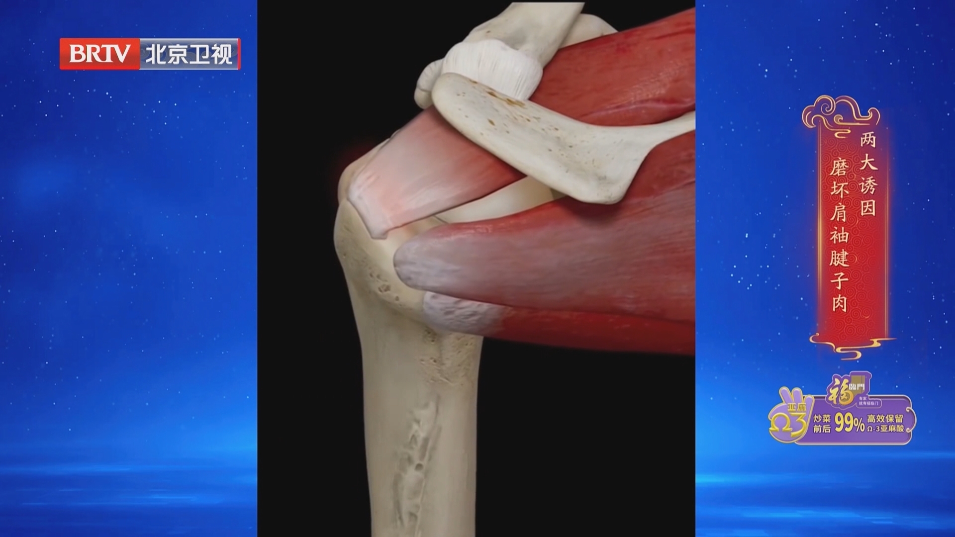 《养生堂》20260114别让“磨坏的肌腱”拖垮生活