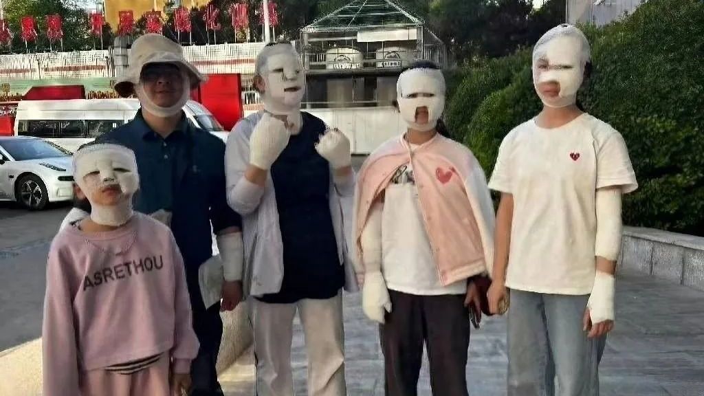 北京房山:野外烧烤受伤,7人被包成“木乃伊”! 北京房山:野外烧烤受伤,7人被包成“木乃伊”!