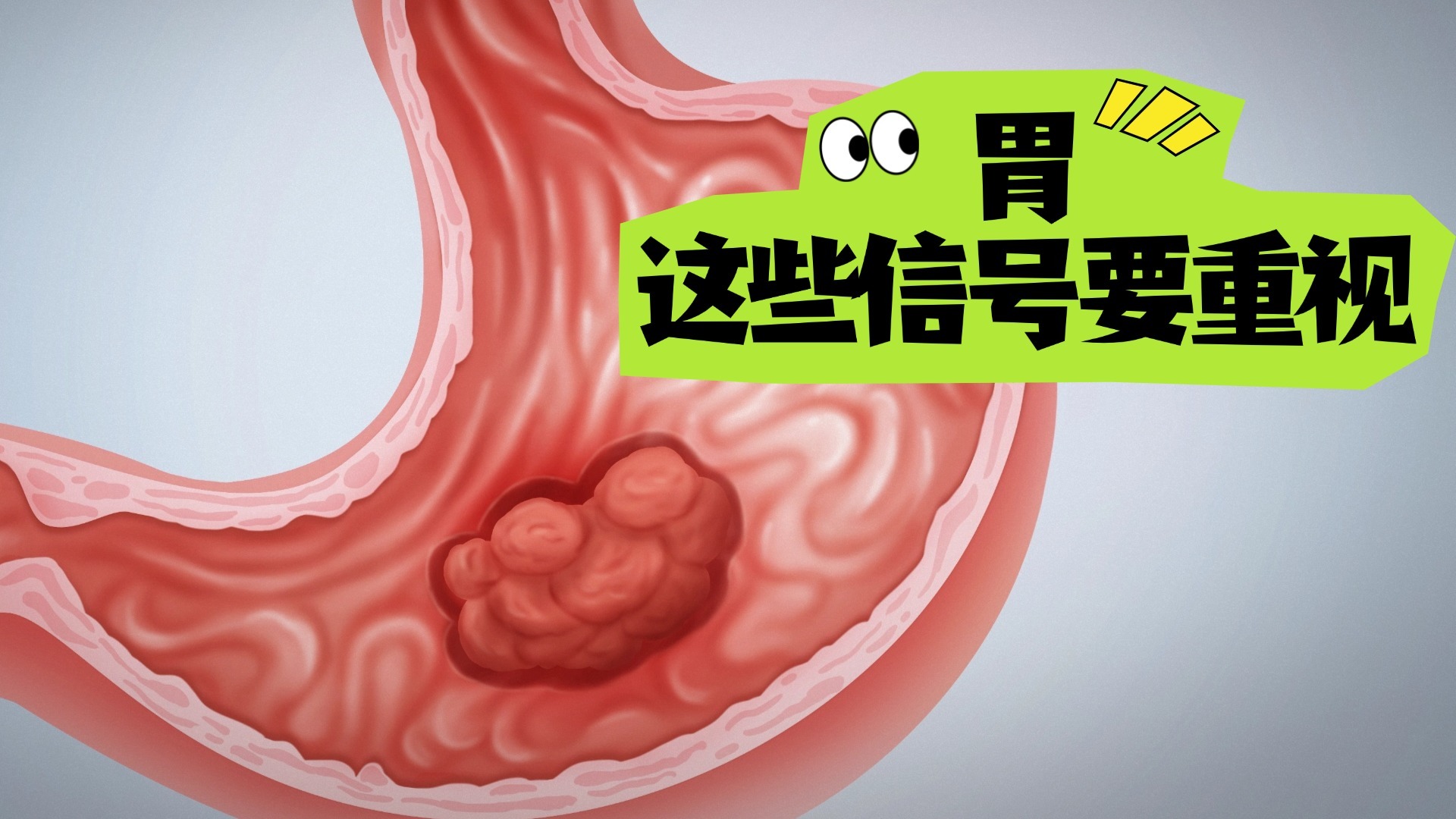 曹颖自曝曾患胃癌！胃的这些信号要重视