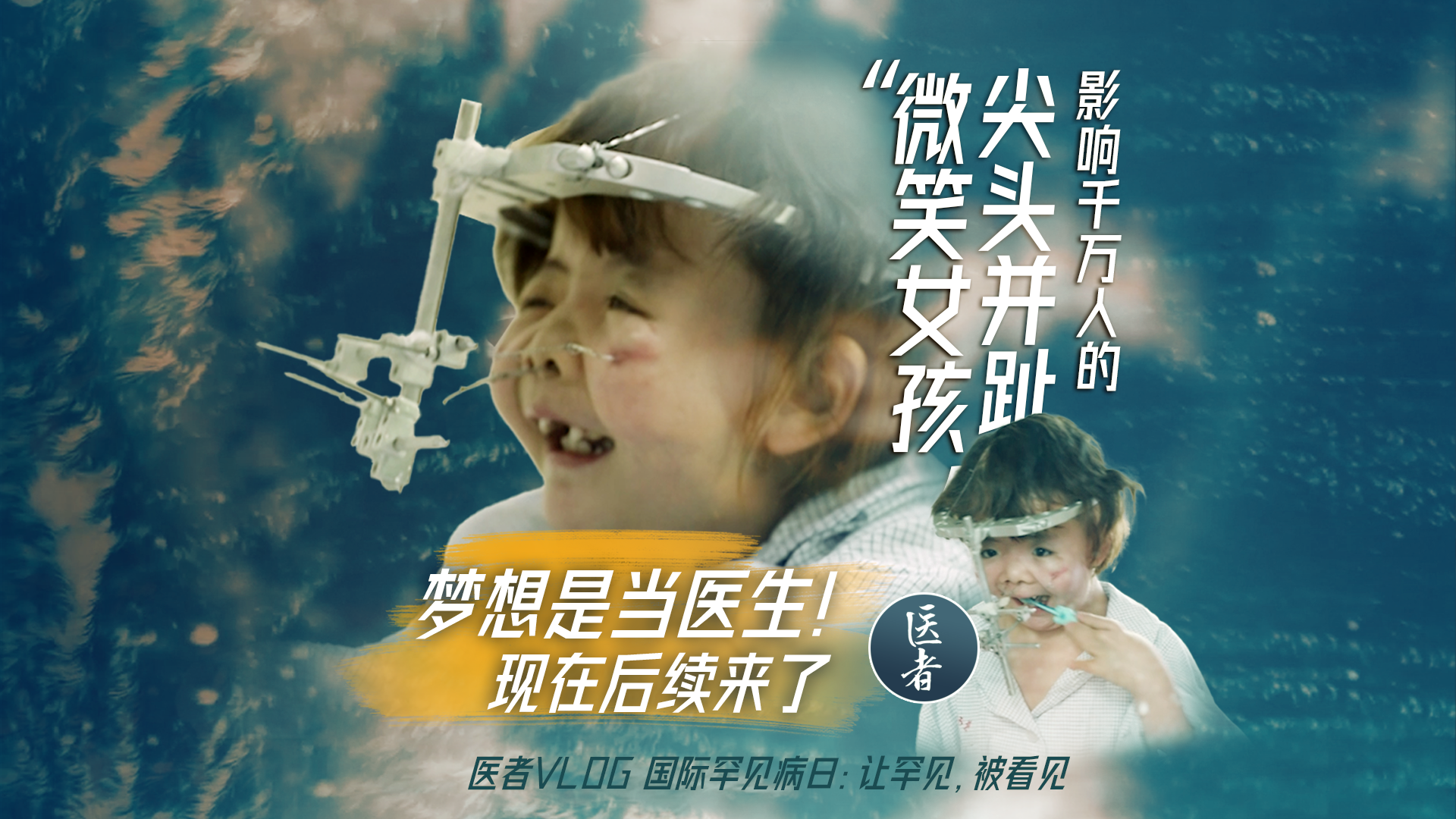 医者｜影响千万人的尖头并趾“微笑女孩”梦想是当医生！现在后续来了