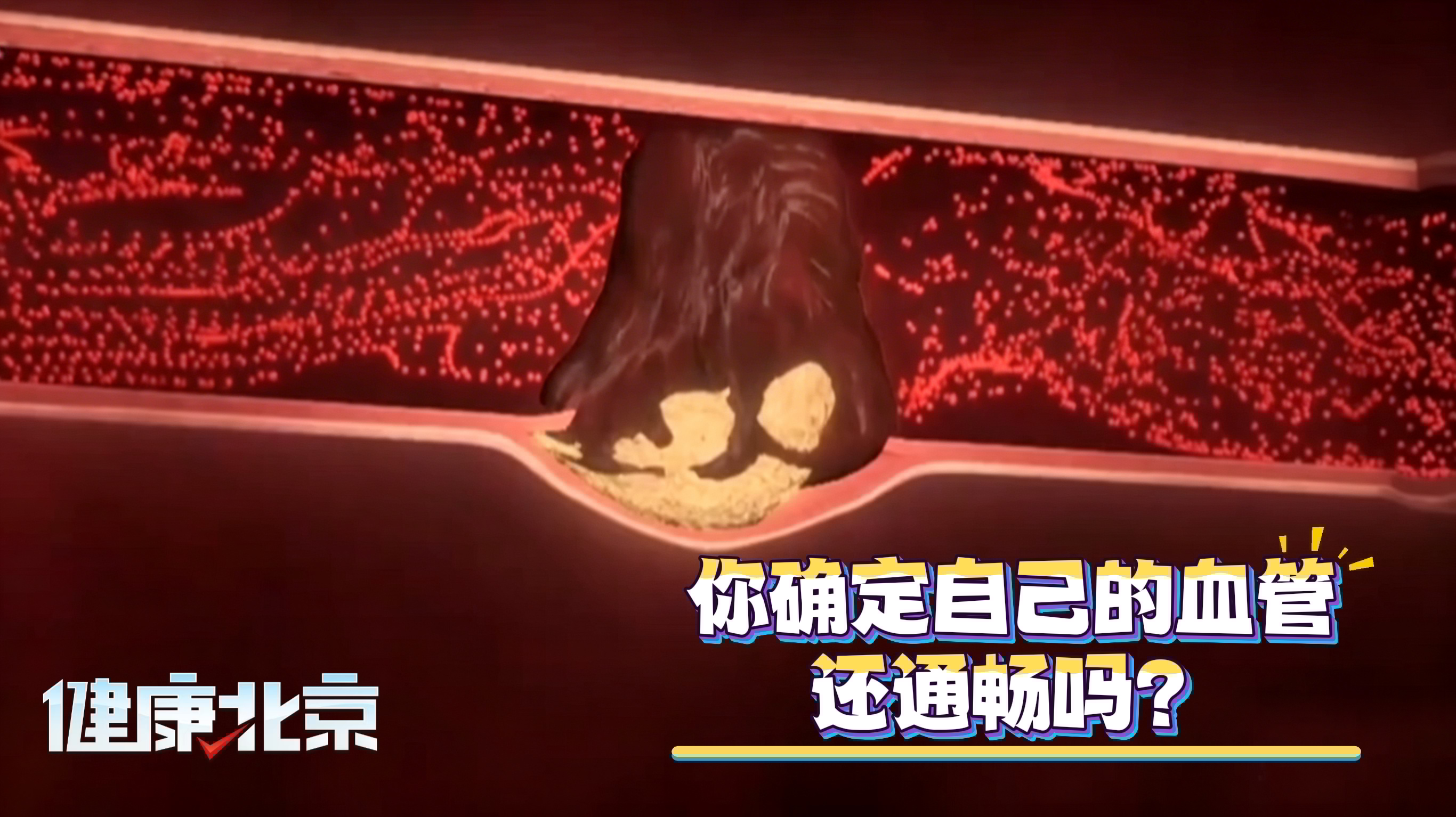 你确定自己的血管还通畅吗? 你确定自己的血管还通畅吗?