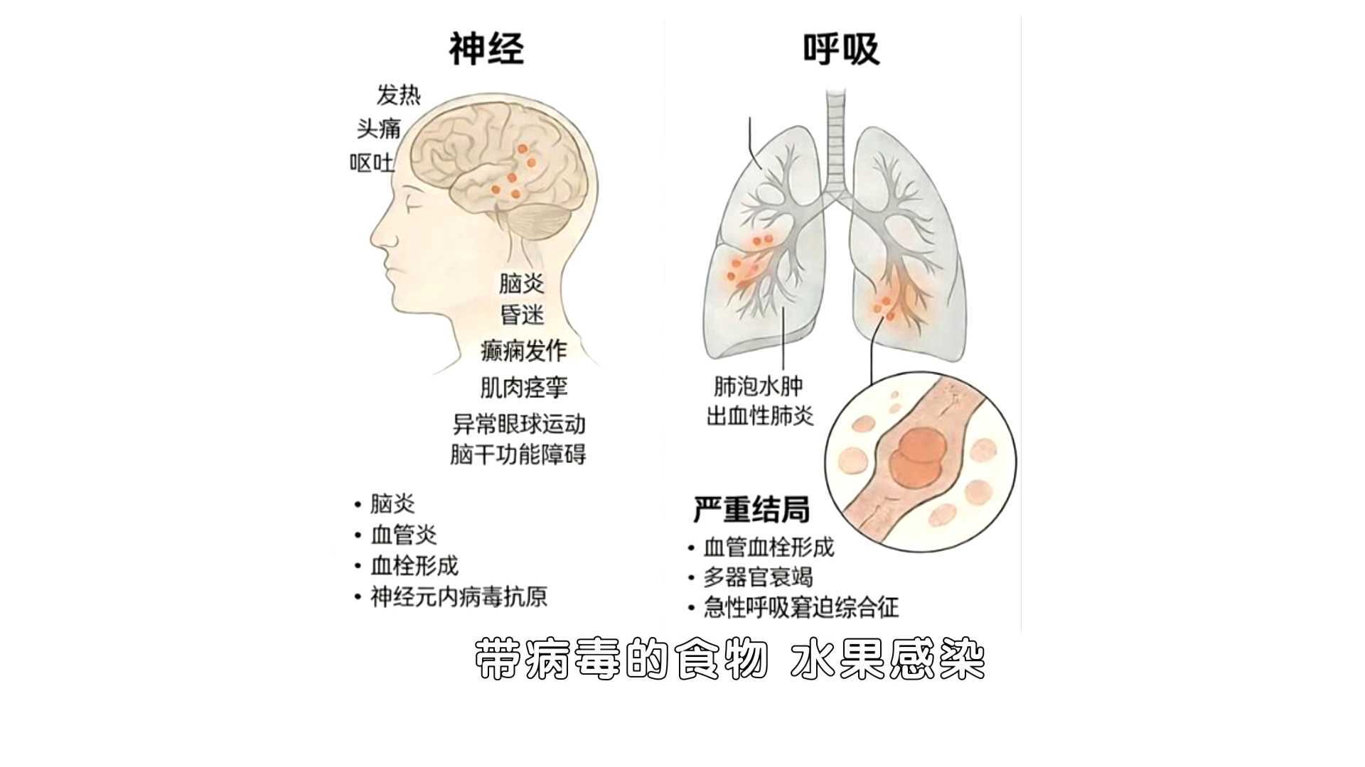 病死率超40%的尼帕病毒  到底从哪来？