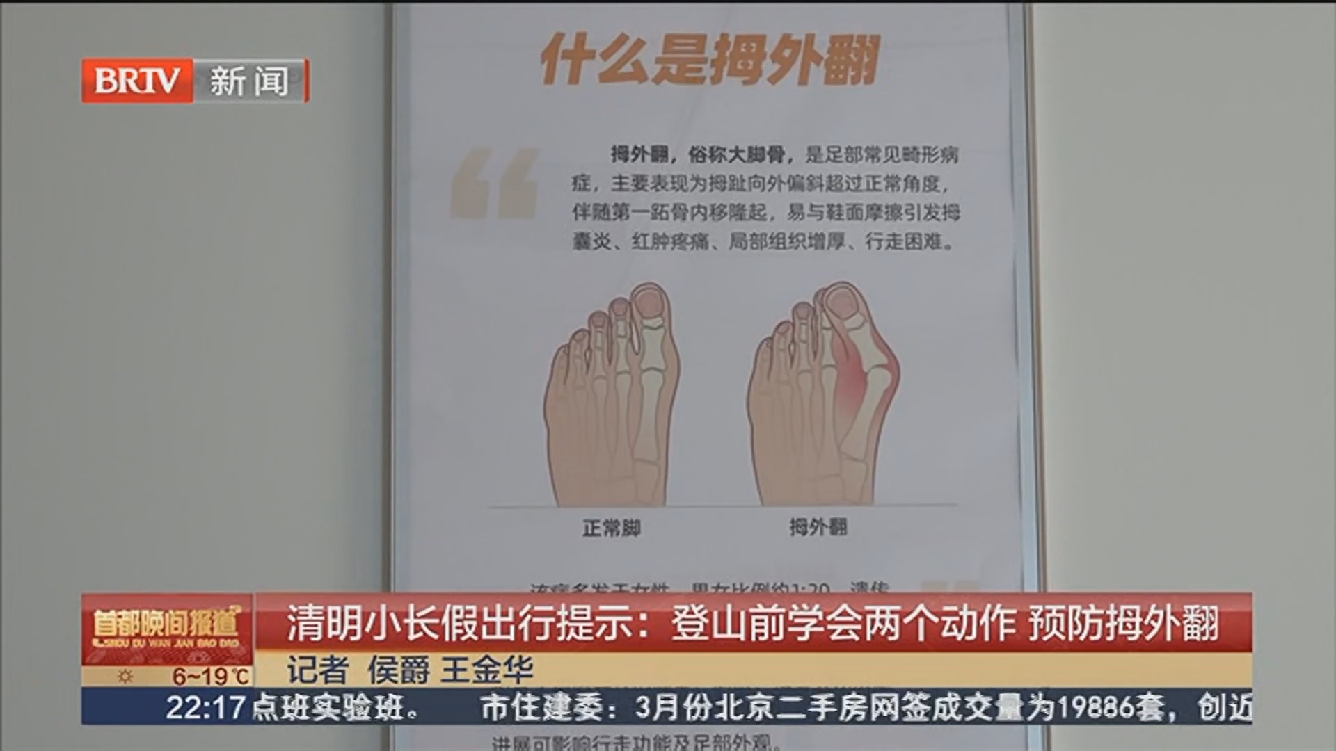 清明小长假出行提示：登山前学会两个动作 预防拇外翻