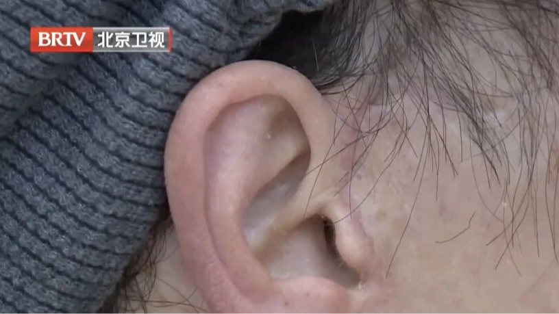 “真的特别闹心”!女子轻信医美宣传“顶尖医师”,怒将医院告上法庭 “真的特别闹心”!女子轻信医美宣传“顶尖医师”,怒将医院告上法庭