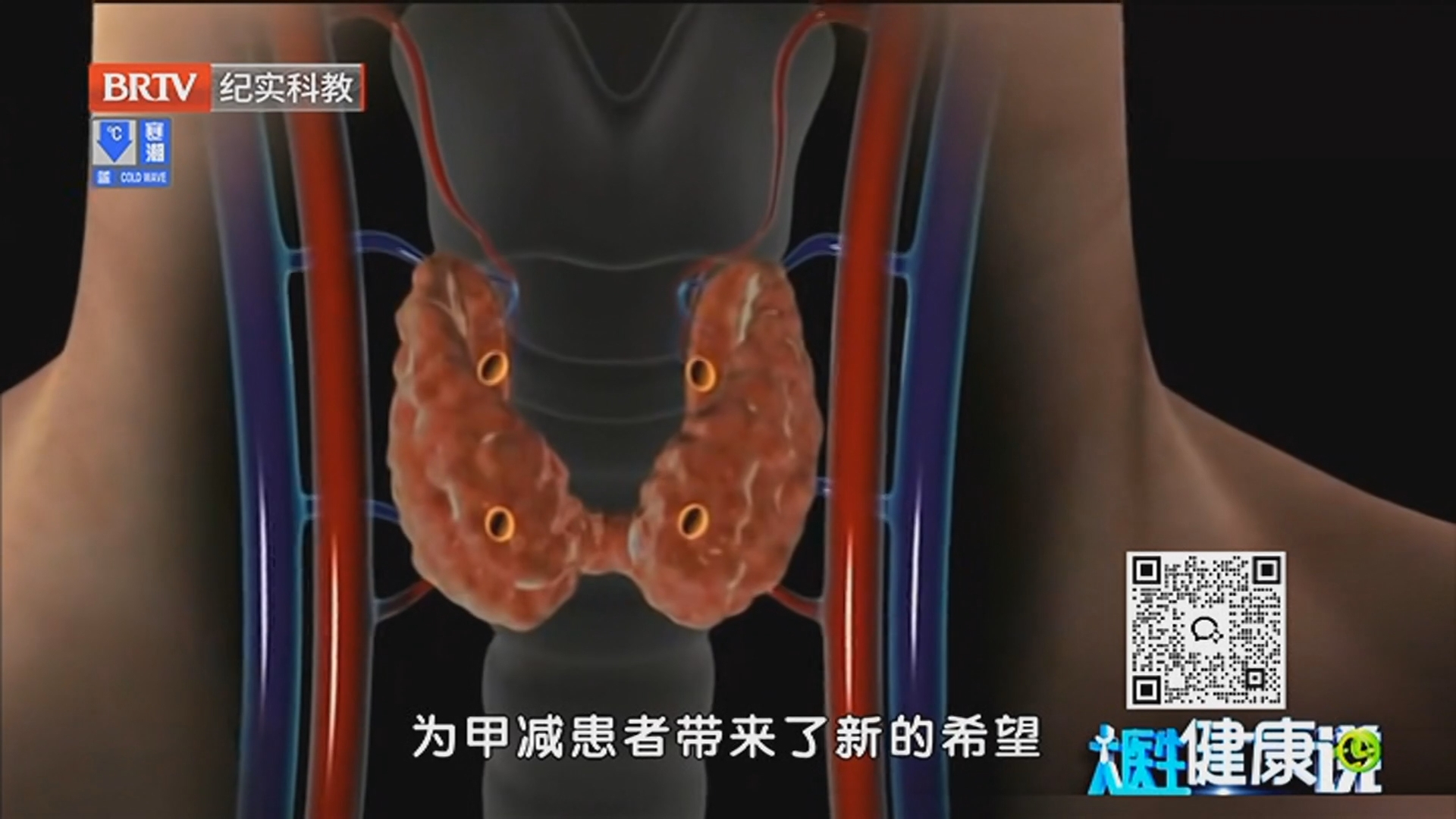 《大医生健康说》20241124攻克甲减顽疾 一招显奇效_北京时间