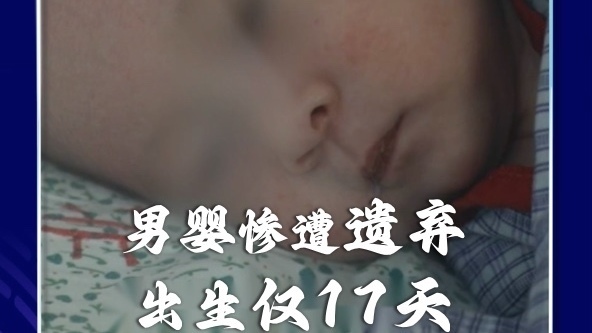男婴惨遭遗弃,出生仅17天!后颈半个头大小的巨大肿物或是原因(3) 男婴惨遭遗弃,出生仅17天!后颈半个头大小的巨大肿物或是原因(3)