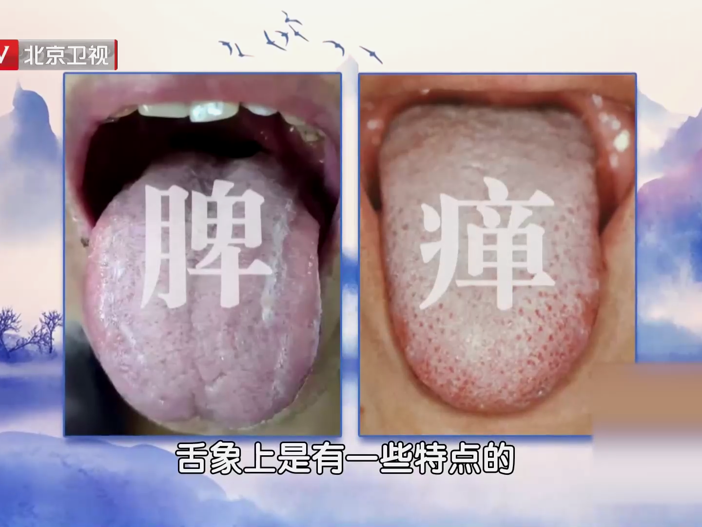 舌苔粘腻、厚浊涎沫、舌质偏红,可能你的脾有内热了 舌苔粘腻、厚浊涎沫、舌质偏红,可能你的脾有内热了