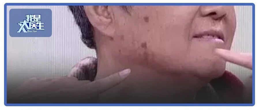 3种睡眠习惯最易长斑，赶紧改！