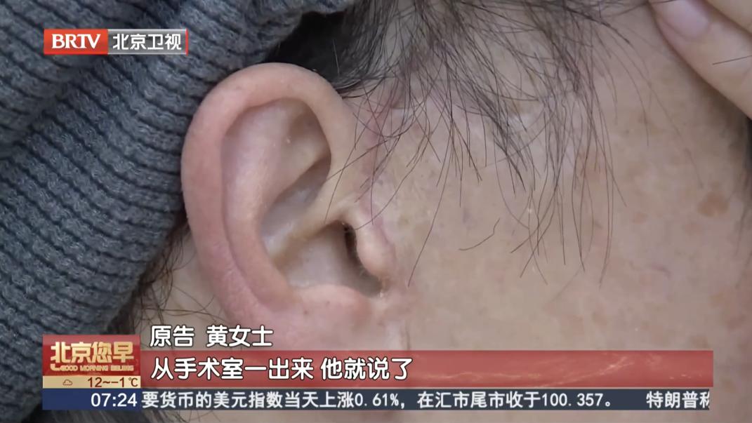 女子轻信医美宣传“顶尖医师”,术后怒将医院告上法庭…… 女子轻信医美宣传“顶尖医师”,术后怒将医院告上法庭……