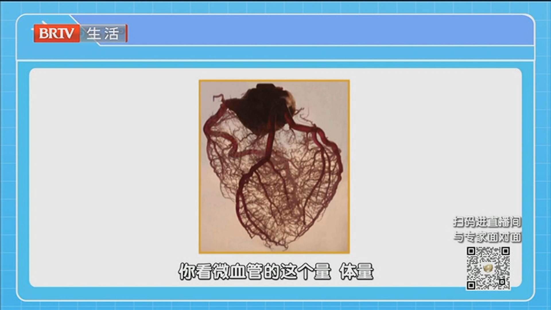 《全民健康学院》20251229血管未见堵塞 为何出现胸闷胸痛