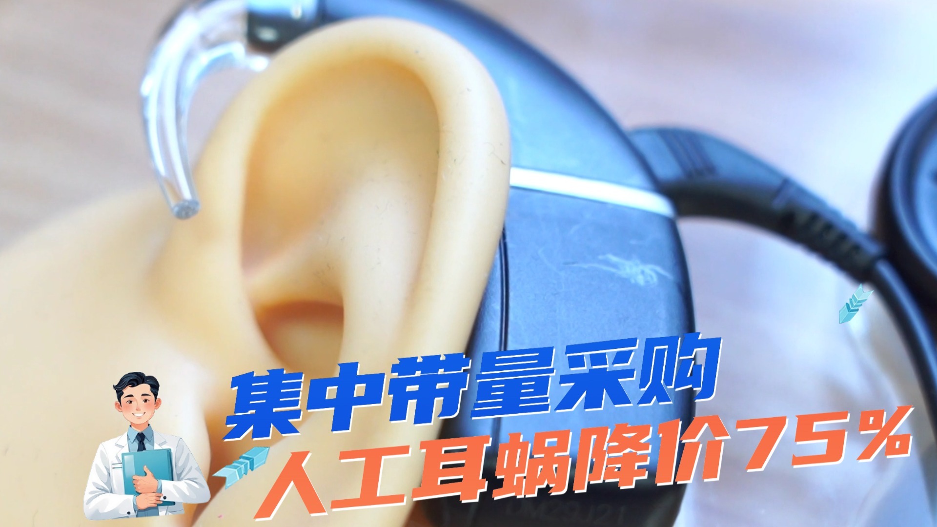 集中带量采购 人工耳蜗降价75% 集中带量采购 人工耳蜗降价75%