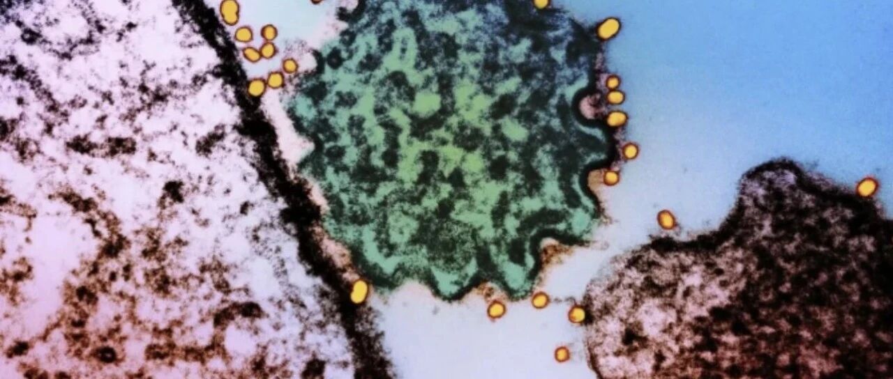 印度尼帕病毒暴发，病死率高达40%-75%！专家最新解读——