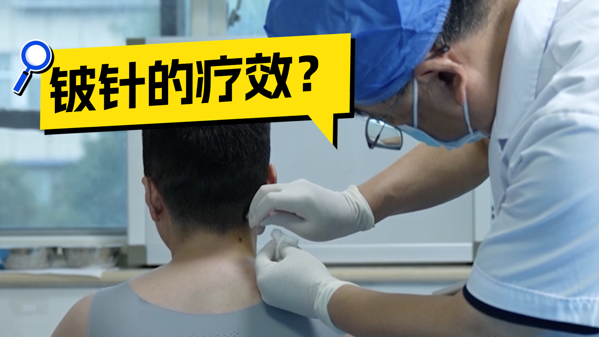 中医铍针治疗颈肩 腰腿疼痛