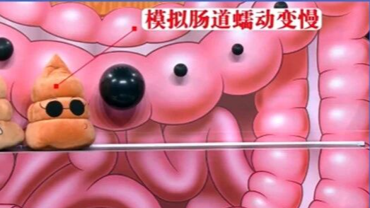 12岁确诊肠癌,罪魁祸首竟然是这些东西!很多家庭还在犯…… 12岁确诊肠癌,罪魁祸首竟然是这些东西!很多家庭还在犯……