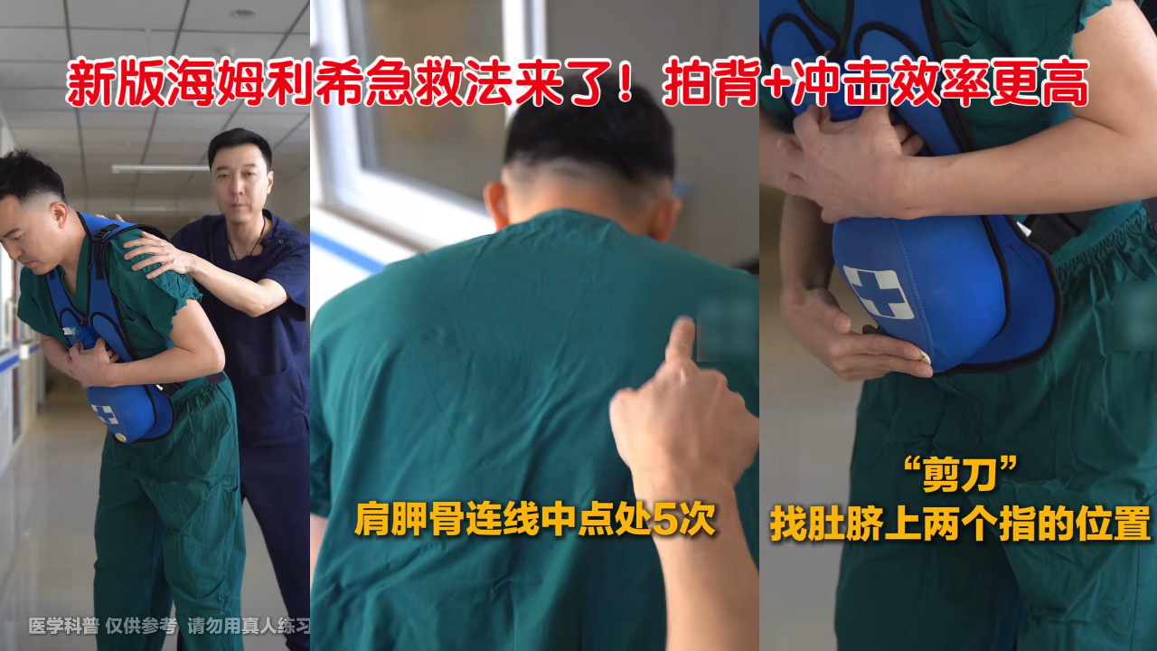 新版海姆利希急救法来了！拍背+冲击效率更高