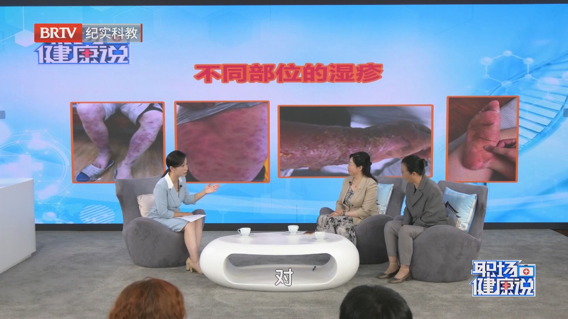 《职场健康说》20260928手脚湿疹VS全身湿疹 破解瘙痒困局! 《职场健康说》20260928手脚湿疹VS全身湿疹 破解瘙痒困局!