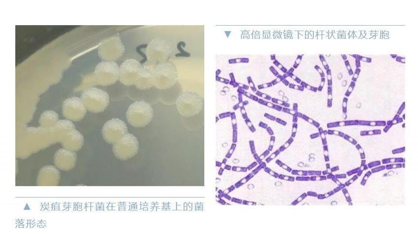山东发现炭疽病例！最新通报来了→