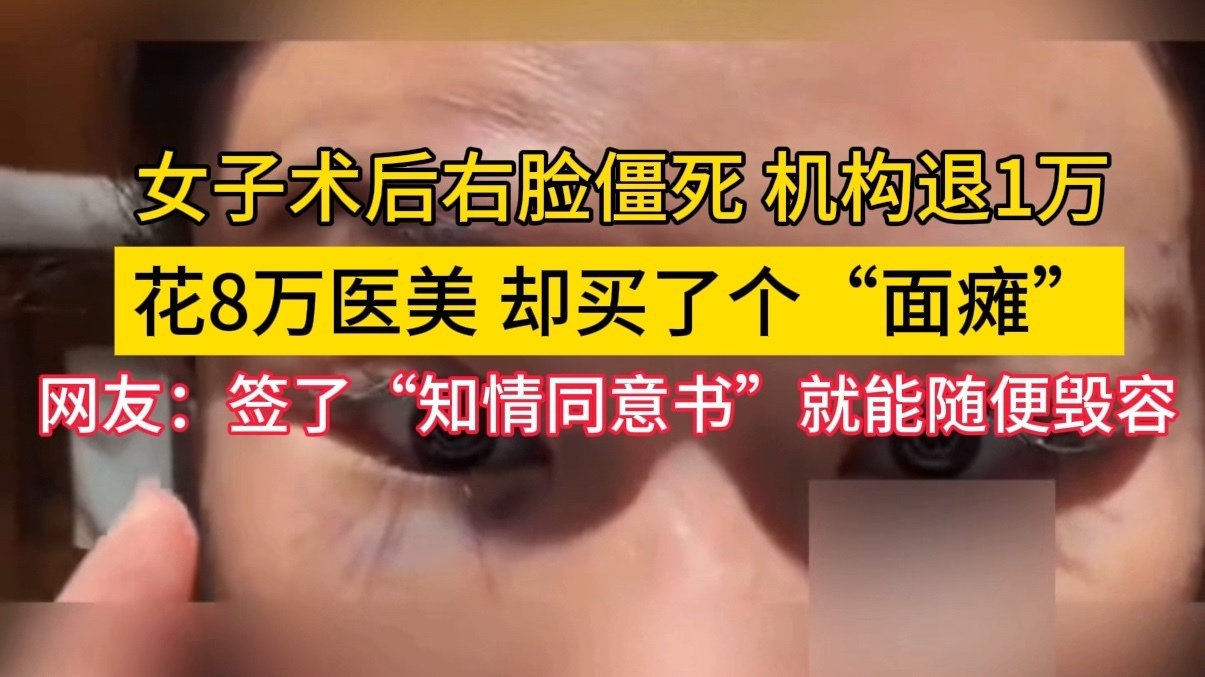 花8万医美，却买了个“面瘫”