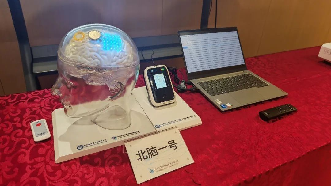 已有5例患者植入,“北脑一号”智能脑机系统进入临床验证阶段 已有5例患者植入,“北脑一号”智能脑机系统进入临床验证阶段