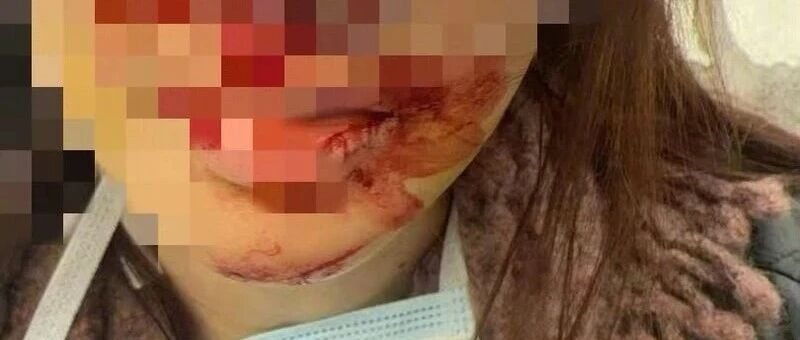 金晨算不算肇事逃逸?助理谎报违法吗?律师解读—— 金晨算不算肇事逃逸?助理谎报违法吗?律师解读——