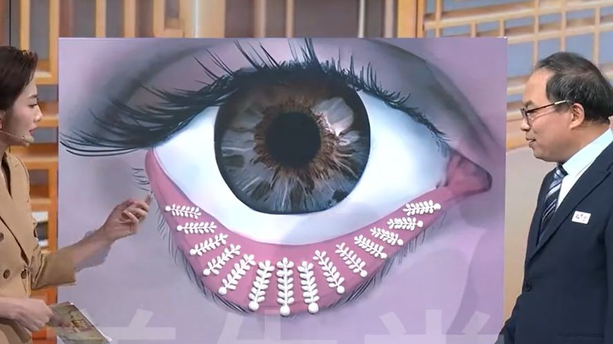 眼睛里的“油管”堵了,再贵的眼药水也白费! 眼睛里的“油管”堵了,再贵的眼药水也白费!