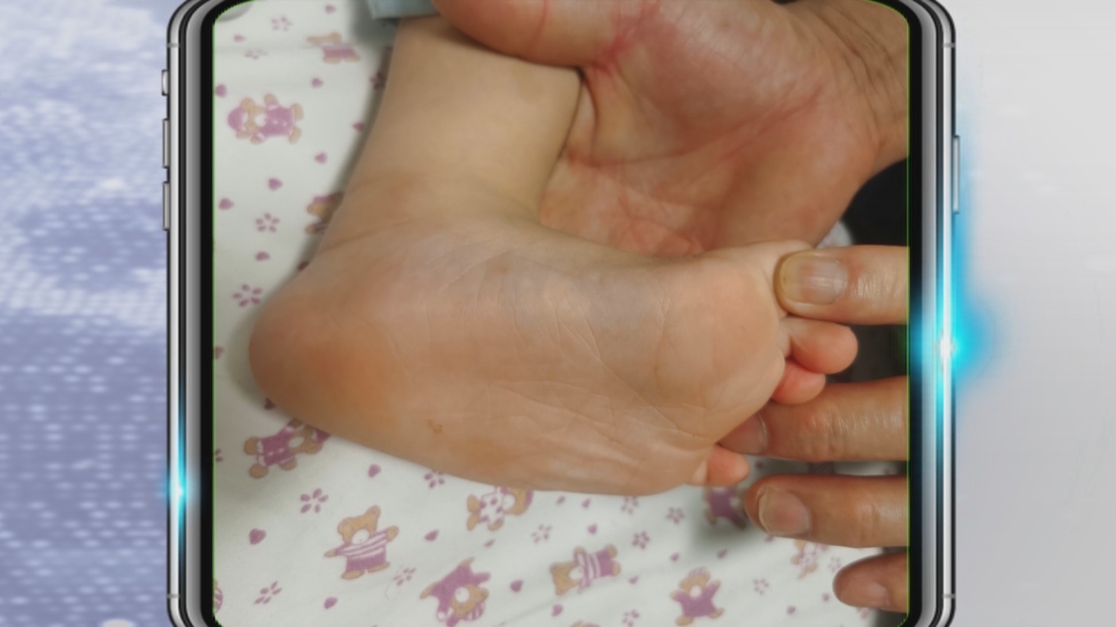 手足口病进入高发期 发现异常要及时就诊_北京时间