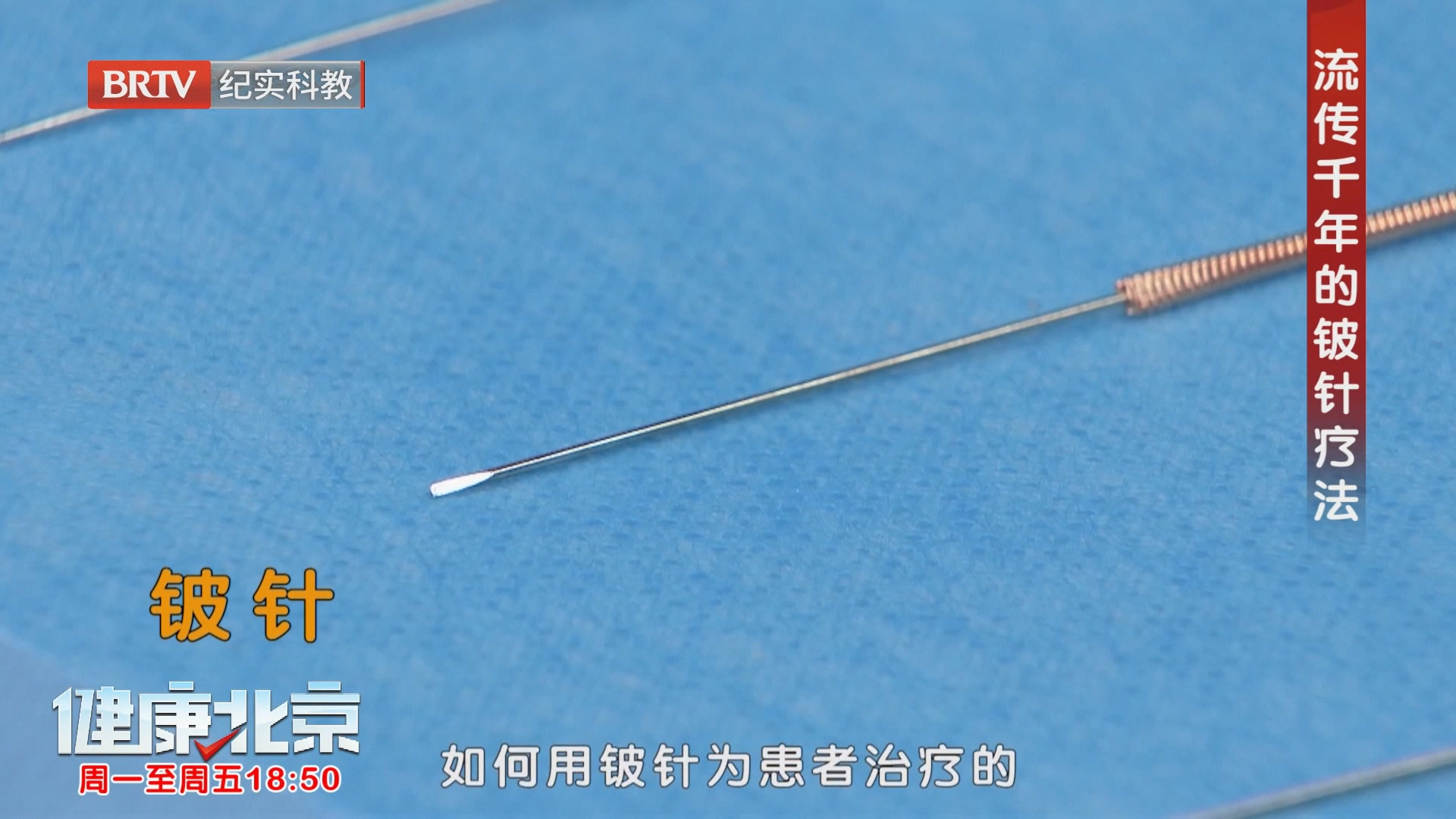 中医专家演示用铍针治疗分五步